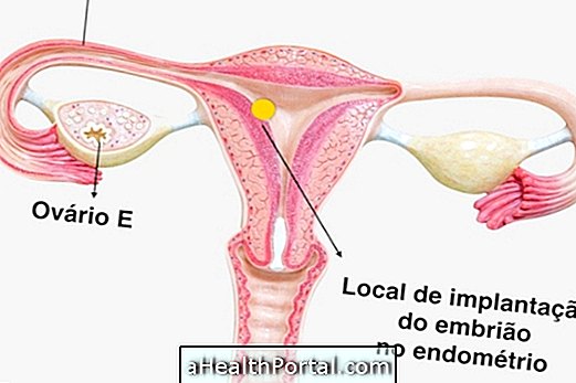 Kuidas ravida õrna endomeetriumi rasestumist
