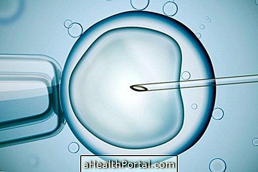 Das Einfrieren von Ovula ist eine Option, um schwanger zu werden, wenn Sie möchten