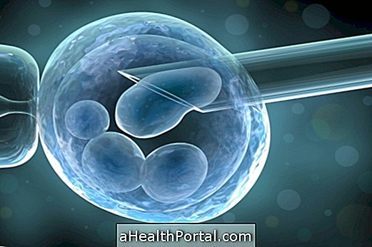 Artificial insemination: what it is, how much it costs and how it is made