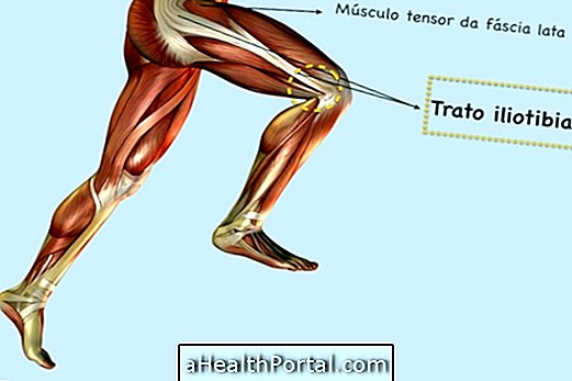 How to Cure Iliotibial Band Syndrome