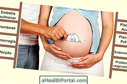 Connaître les risques d'accouchement par césarienne
