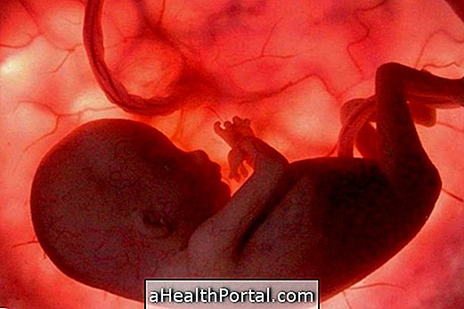 Hvad er fosterskader og hvad er dens tegn
