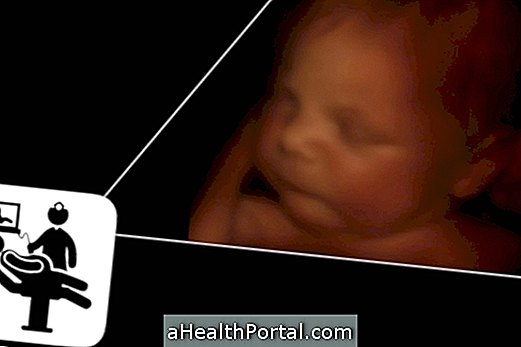 3D and 4D Ultrasound show details of baby's face and identify diseases