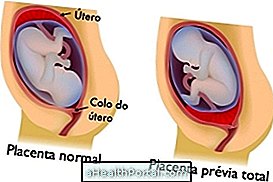 Was ist Placenta vor und wie man es identifizieren kann