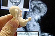 Babyentwicklung - 11 Wochen schwanger