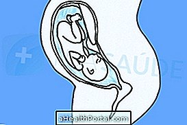 Hvad skal man gøre i tilfælde af nedsat amniotisk væske