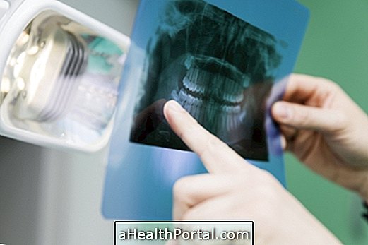 Hambaravi tsüst - mis see on ja kuidas seda ravitakse