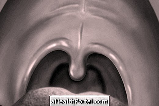 What can be the lump in the roof of the mouth?