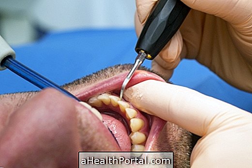 Behandlung bei Parodontitis