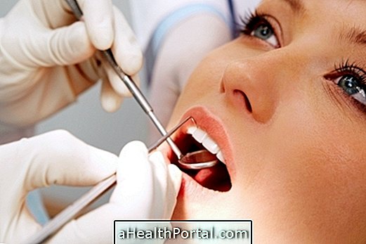 How Caries Removal Treatment is Done
