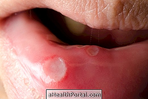 Suu vähi sümptomid