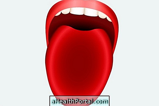舌の色で病気を特定する方法