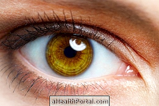 Kuidas ravida allergiat silma
