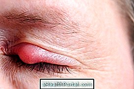 Co je terkol v oku a jak léčit