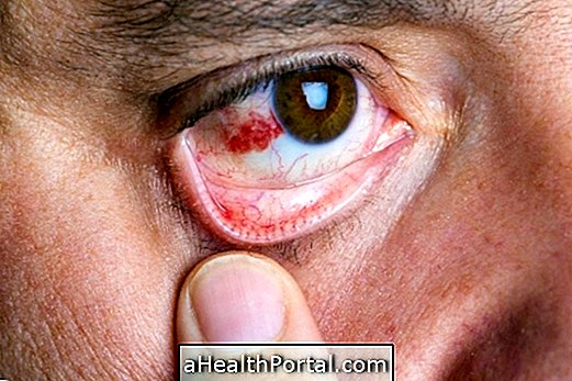 Mikä voi olla Red Spot in the Eye ja miten hoitaa