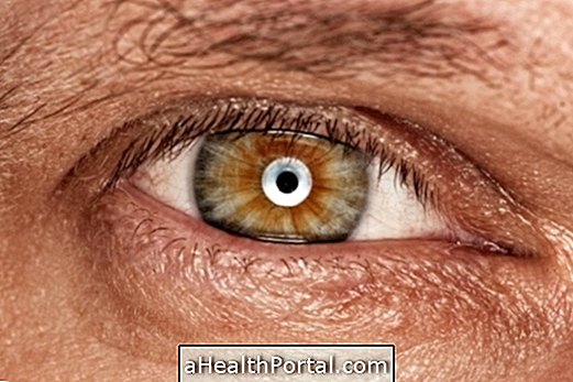 What is Optic Neuritis and How to Identify