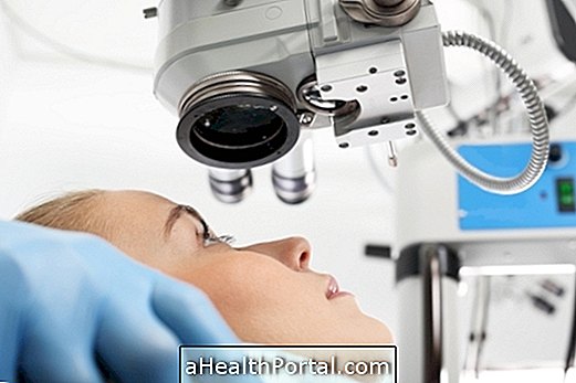 Myopia Surgery: Mikor kell csinálni, típusokat, helyreállítást és kockázatokat