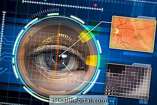 Hvad er Purtscher's retinopati og hvordan man kan identificere