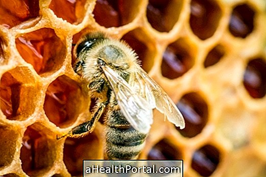 Elsősegély a méhcsípés esetén