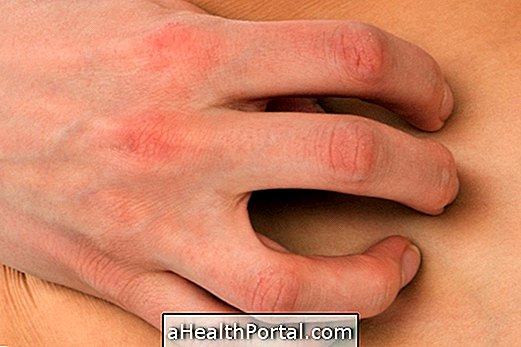 Home Remedies for Every Type of Itchy Skin