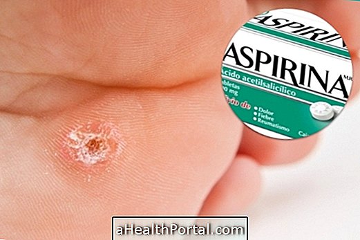 Jak používat Aspirin k odstranění suchých volů