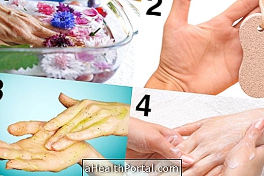 4 trin til at fjerne calluses fra hænder