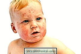 赤ちゃんの赤い斑点：それは何ですか？