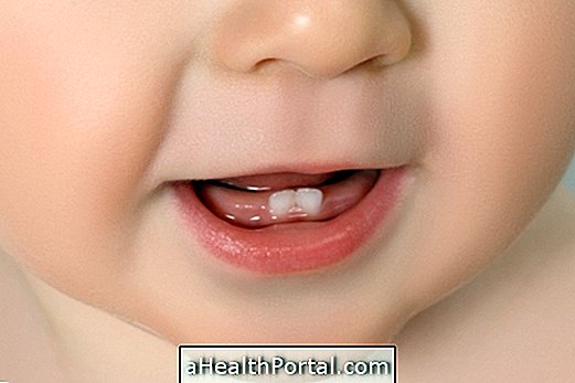 Millal võtta beebi hambaarstile esmakordselt