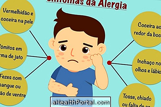Як дізнатися, чи у вашої дитини алергія на молоко?