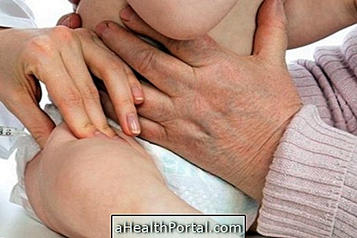 Botox voi auttaa hoitamaan vauvoja Microcephalian kanssa