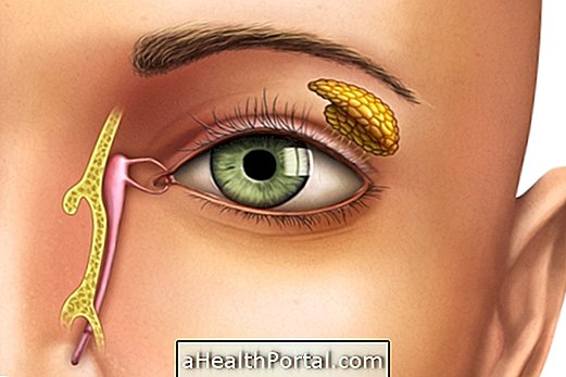 Blocked tear canal: see what it might mean