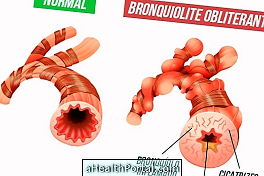 Kuidas nakatunud bronhioliit tuvastada ja ravida