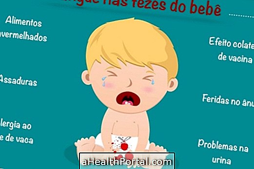 7 Causes of Blood in Baby's Diaper