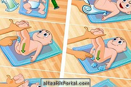 Comment prévenir la dermatite de la couche chez le bébé