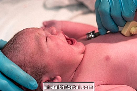 What is omphalocele and how is the treatment