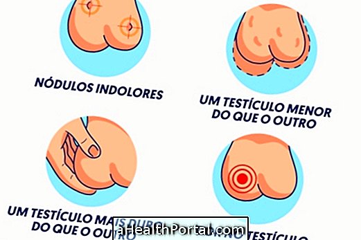 Top 5 Symptoms of Testicular Cancer and How to Treat It