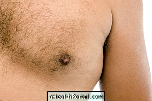 Sümptomid ja rinnavähi ravi meestel