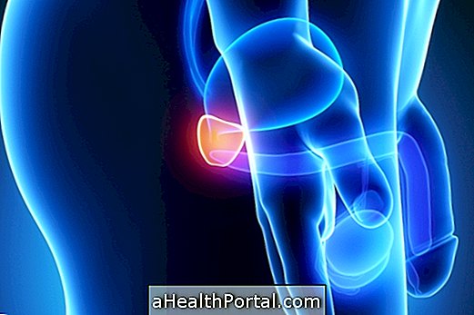 Post-operative and consequences of surgery to remove the prostate