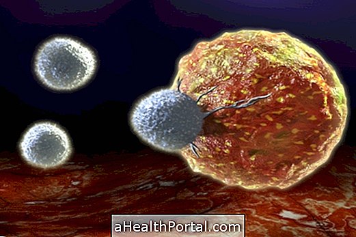 Prostatas vēža ārstēšanas iespējas