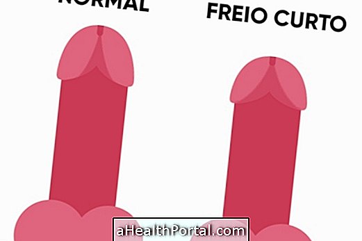 Mitä se on ja miten lyhyt penisjarrutus leikkailee