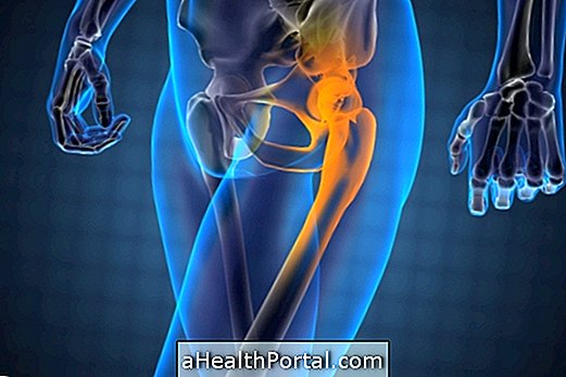 Douleur à la hanche - Causes communes et traitements