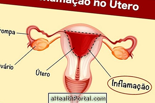 Symptômes d'infection dans l'utérus