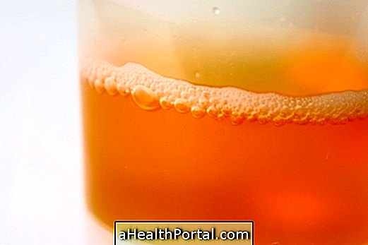 Find ud af, hvad der er hovedårsagerne til urin med skum