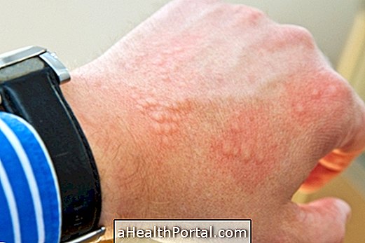 7 diseases that cause red spots on the skin