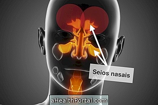 Symptoms of Sinusitis and How to Differentiate the Major Types
