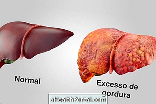 Symptoms of Fat in the Liver and How to Eliminate