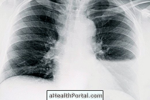 Symptomer på vand i lungen