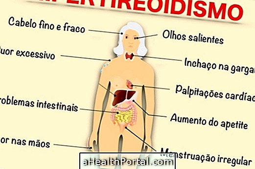 Symptomer på hyperthyroidisme