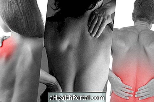 Ved, hvad det kan forårsage, og hvordan man lindrer rygsmerter