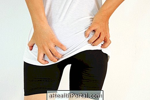 Causes and treatments for anal itching